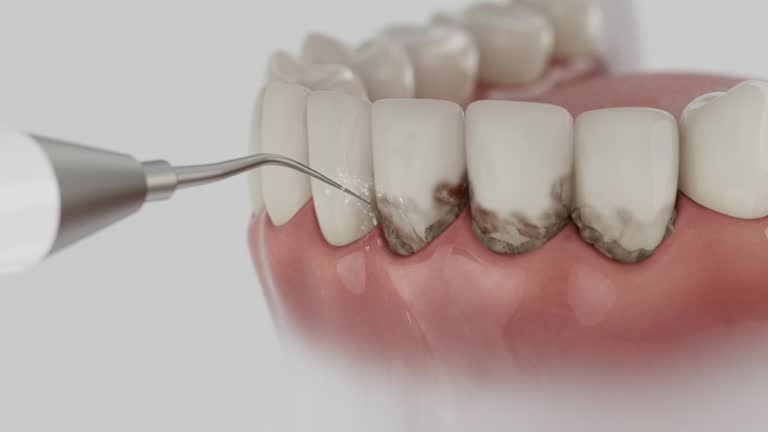 Reliable Emergency Dentist contractor in Pasadena, MD by Smile Center Dentistry